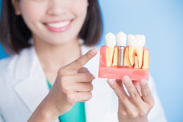 Consult An Implant Specialist To Enhance Your Smile
